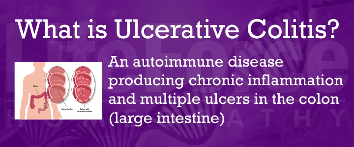 What is Ulcerative Colitis